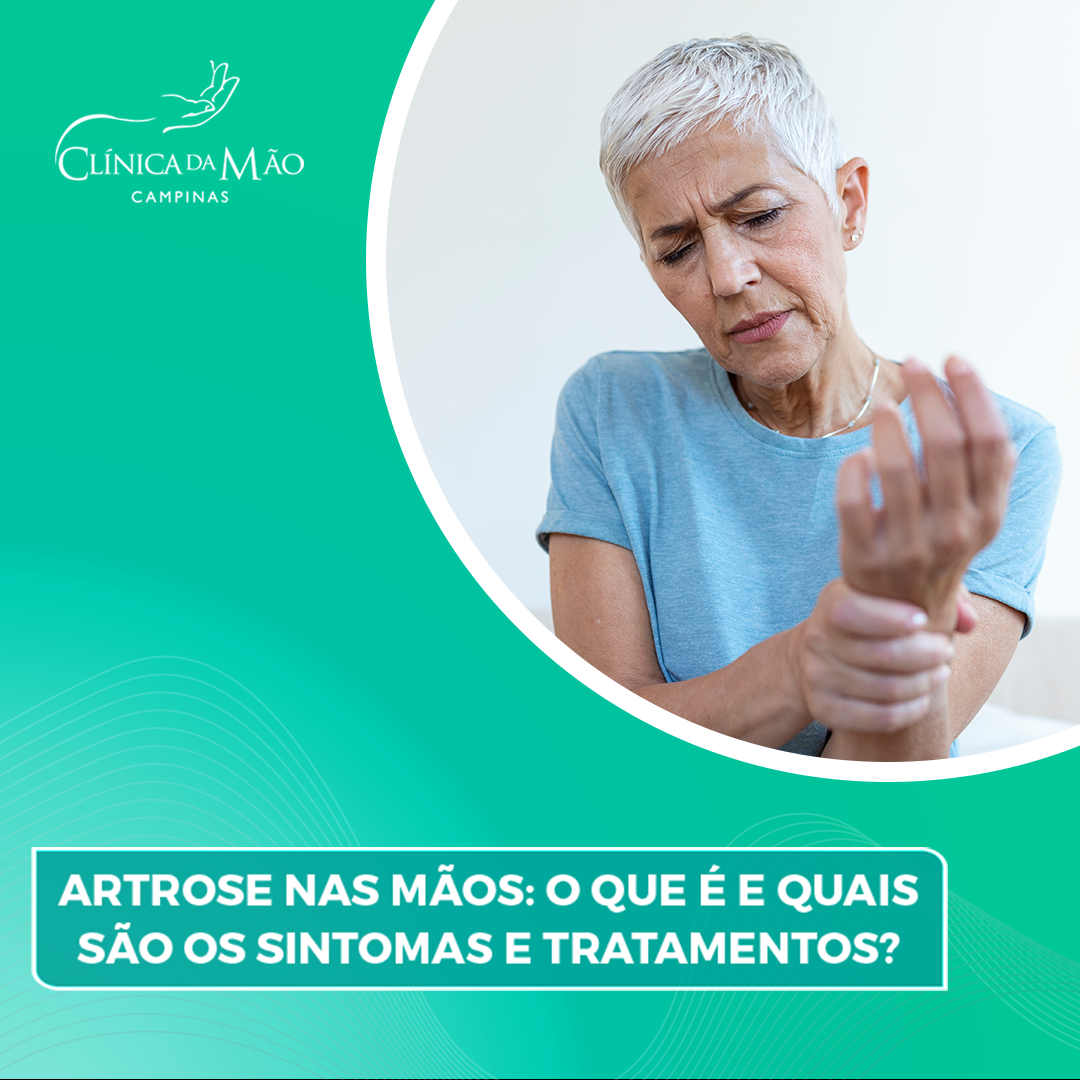 ARTROSE NAS MÃOS SINTOMAS E TRATAMENTO Clínica da Mão 2021