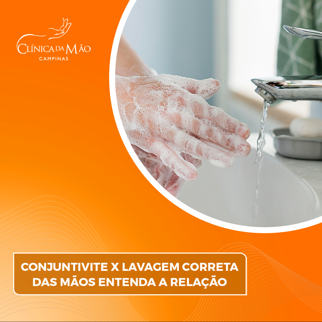 CONJUNTIVITE x LAVAGEM CORRETA DAS MÃOS: ENTENDA A RELAÇÃO - Clínica da ...