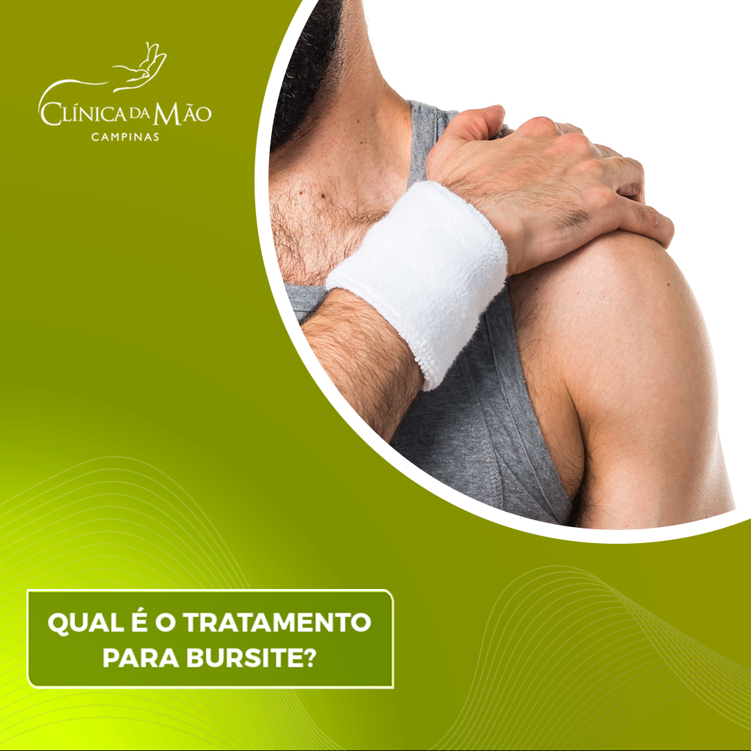 Tratamento de bursite - Clínica da Mão - 2021