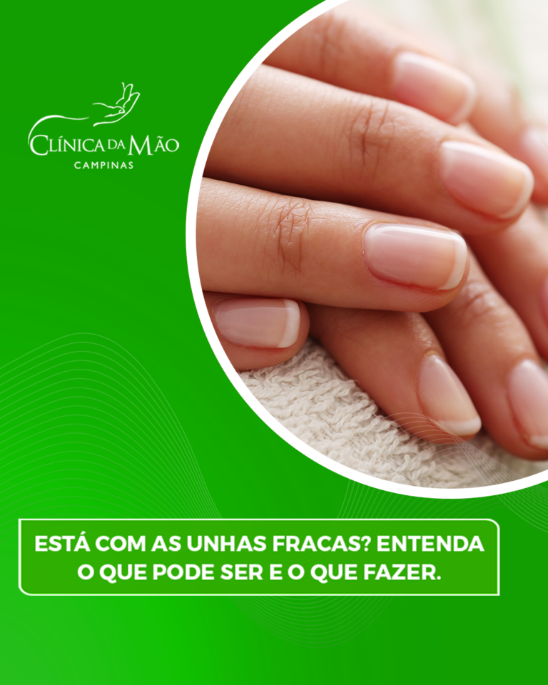 Está com as unhas fracas? Entenda o que pode ser e o que fazer ...
