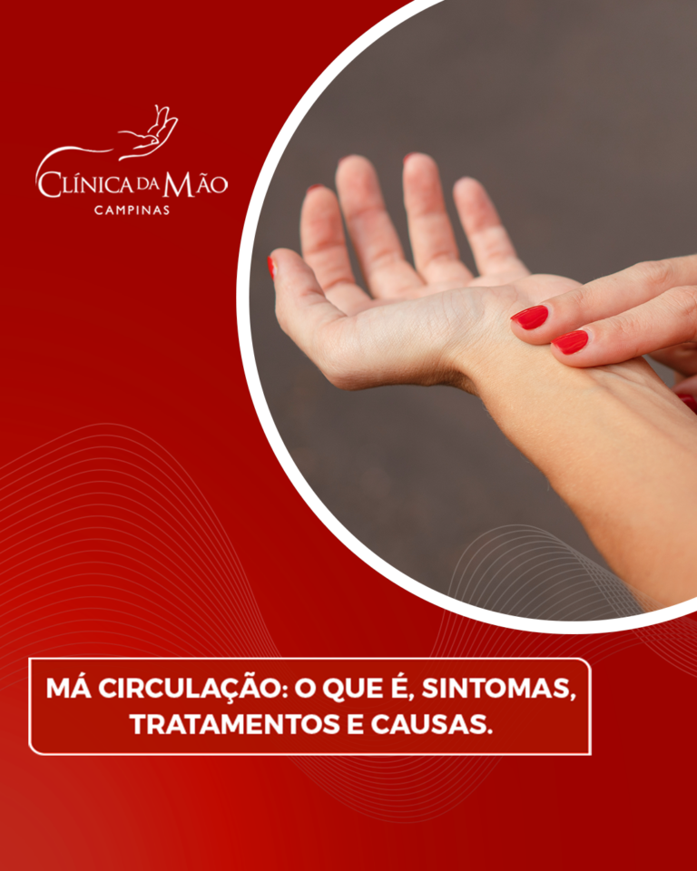 Má circulação: O que é, sintomas, tratamentos e causas. - Clínica da ...
